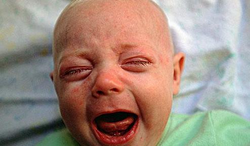 婴儿的部分性癫痫发作有哪些症状